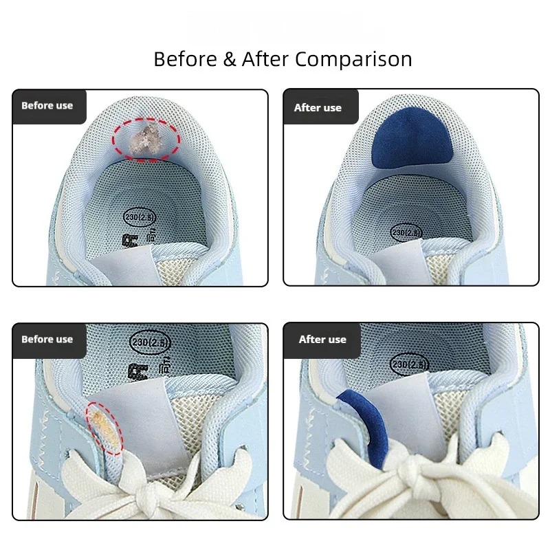 6 szt. Naklejki naprawcze do b – Life Sneaker Care recenzja i cena